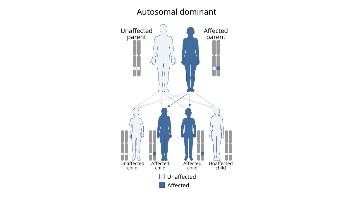 A genetic lineage chart illustrating an autosomal dominant inheritance pattern across generations to assess eligibility for pancreatic cancer screening.