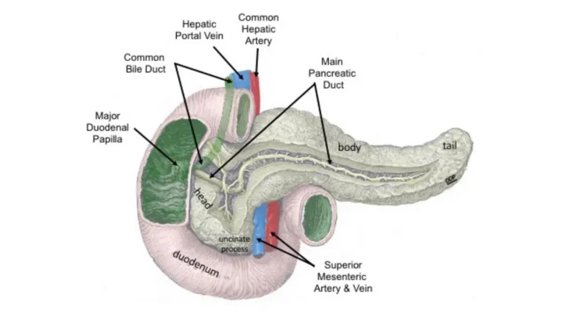 Color-coded anatomical diagram of the biliary duct and pancreatic duct system explaining pancreatic cancer symptoms