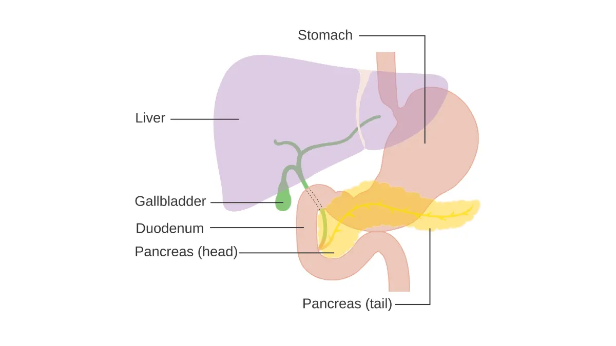 Structural vector mapping showing the precise anatomical location of a pancreatic neuroendocrine tumor within the upper gastrointestinal region.