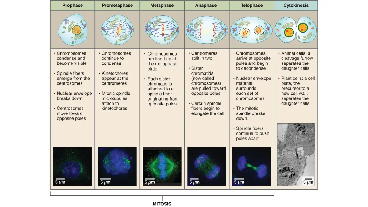 Academic biology diagram explaining how the replication cycle accelerates during a higher-grade pancreatic neuroendocrine tumor diagnosis.
