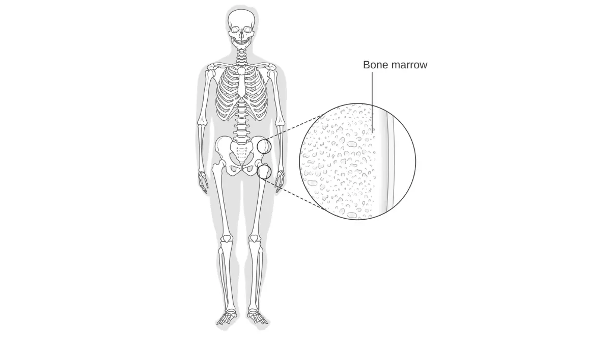 Pluvicto bone marrow illustration showing why blood counts must be monitored during radioligand therapy.