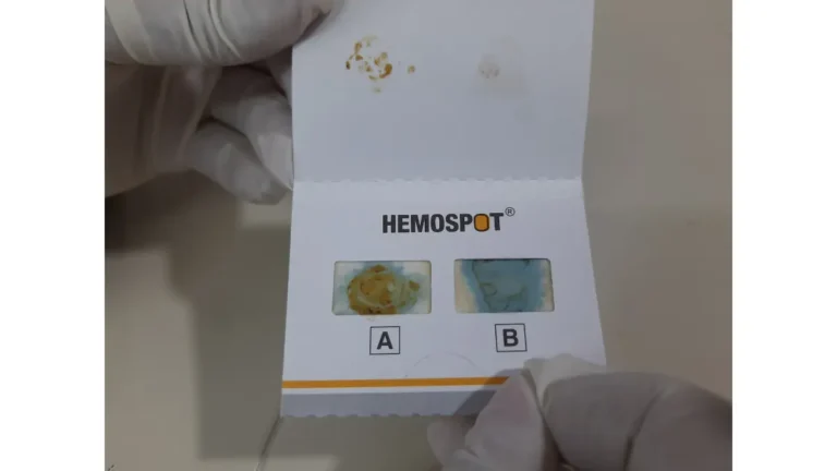 Positive Cologuard stool test card showing a positive fecal occult blood result for colorectal screening.