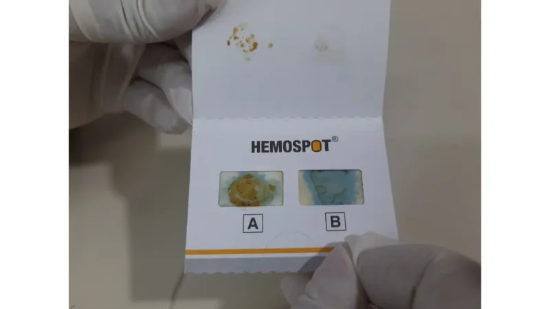 Positive Cologuard stool test card showing a positive fecal occult blood result for colorectal screening.
