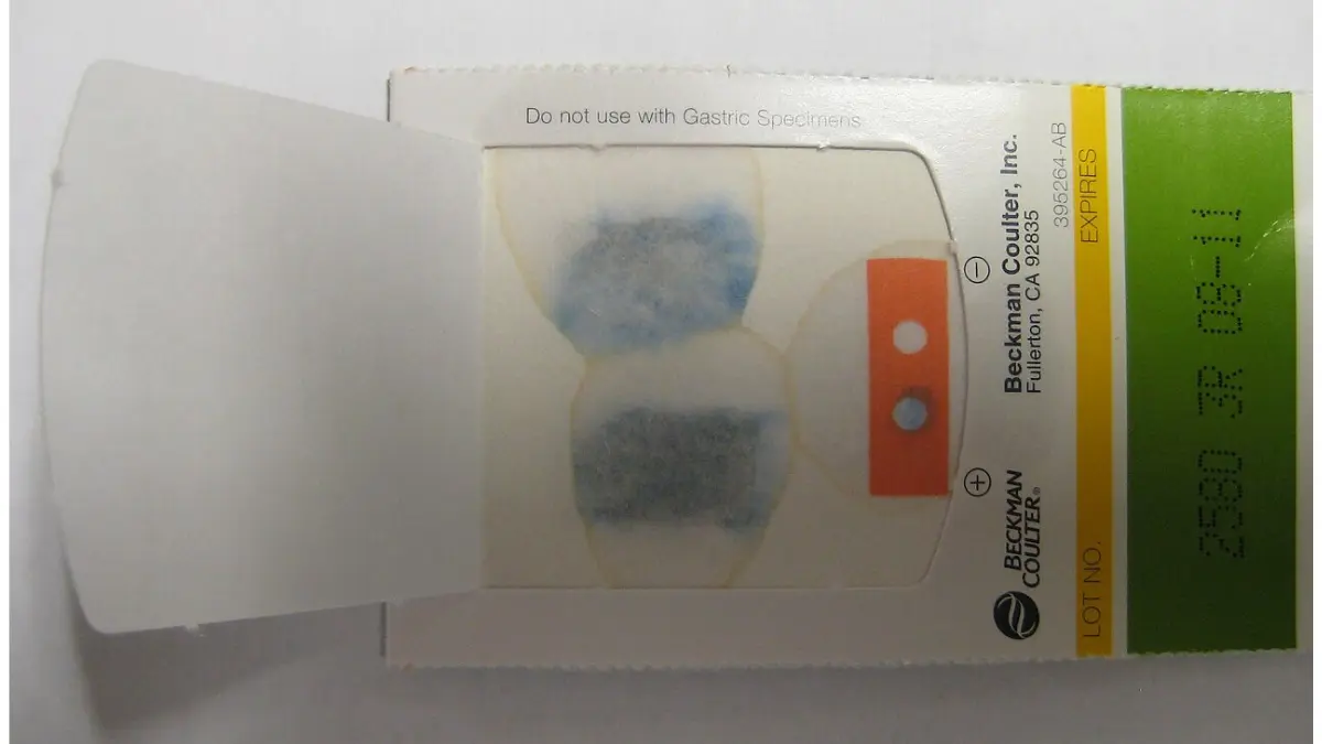 FIT Test positive result example showing a stool blood test outcome that needs follow-up colonoscopy.