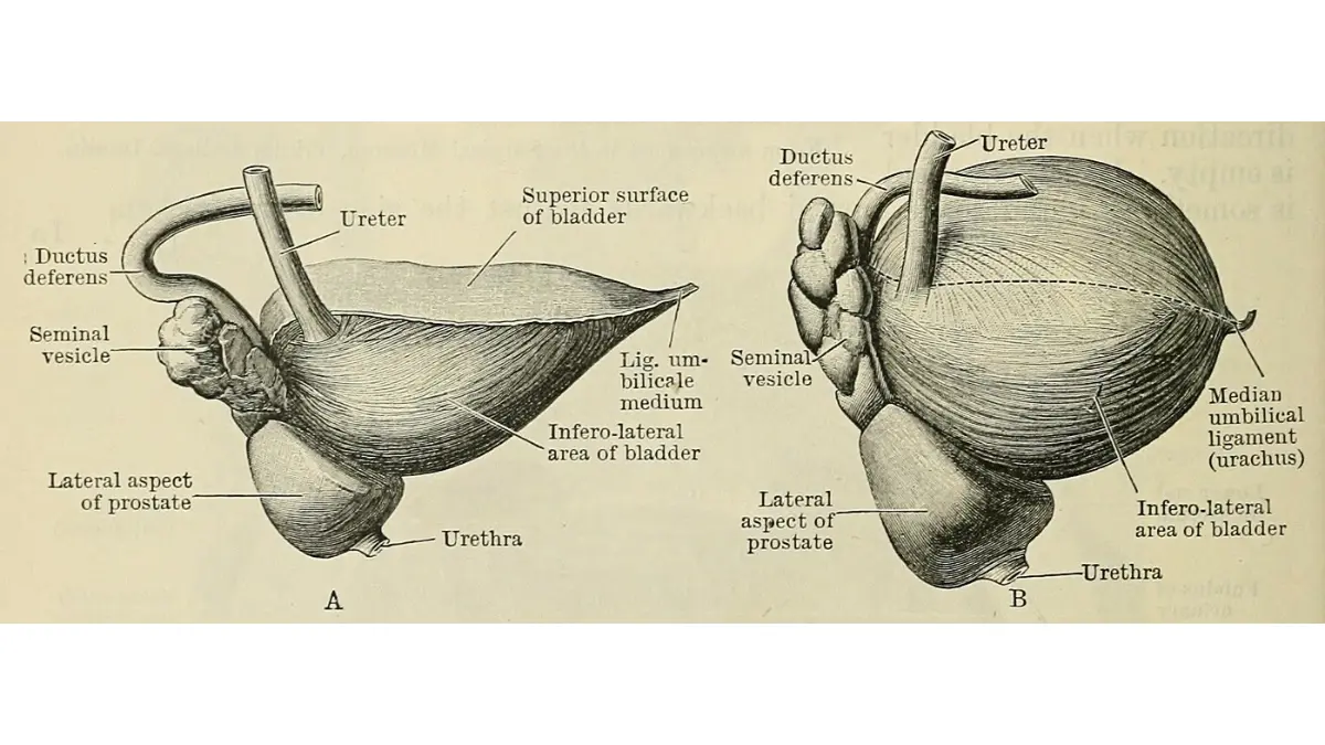 Side-view anatomical illustration of the urinary bladder, prostate gland, and seminal vesicle for patients learning about Prostate Cancer Causes.