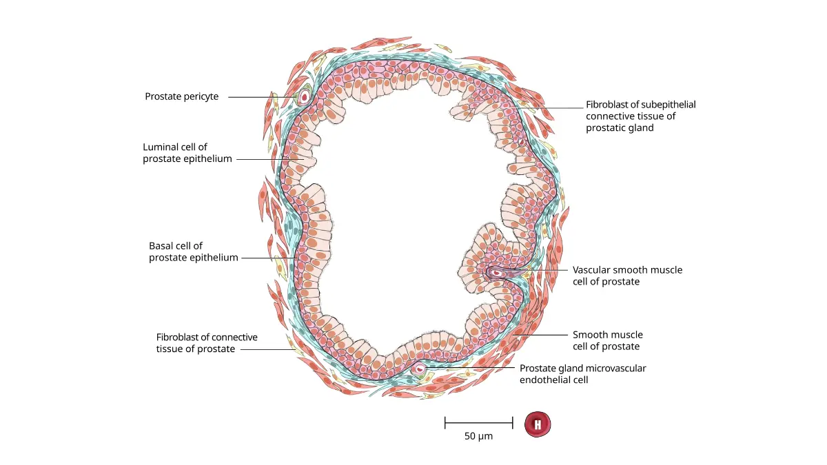 NIH BioArt illustration of the prostate glandular acinus tissue structure for understanding cellular changes in Prostate Cancer Causes.