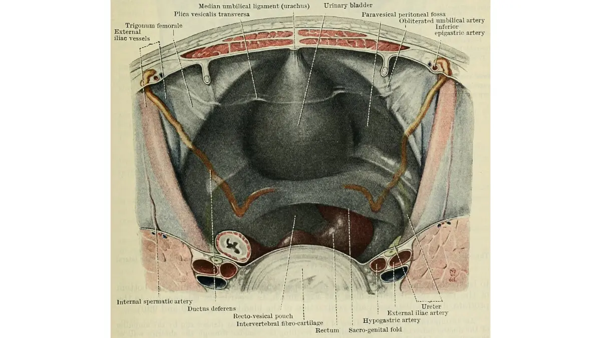 Prostate cancer recurrence pelvic anatomy illustration showing a superior view into the male pelvis and nearby reproductive structures.