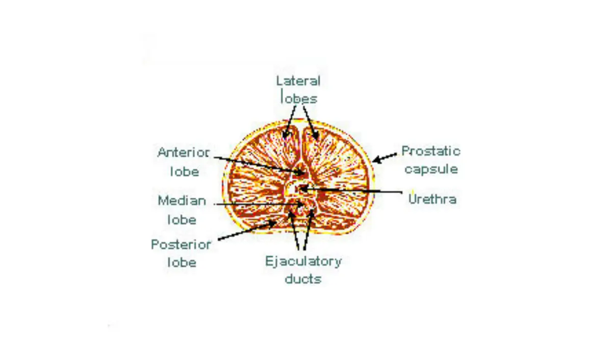 Diagram of prostate lobes surrounding the urethra to illustrate how Prostate cancer side effects arise from surgery and radiation near urinary structures.