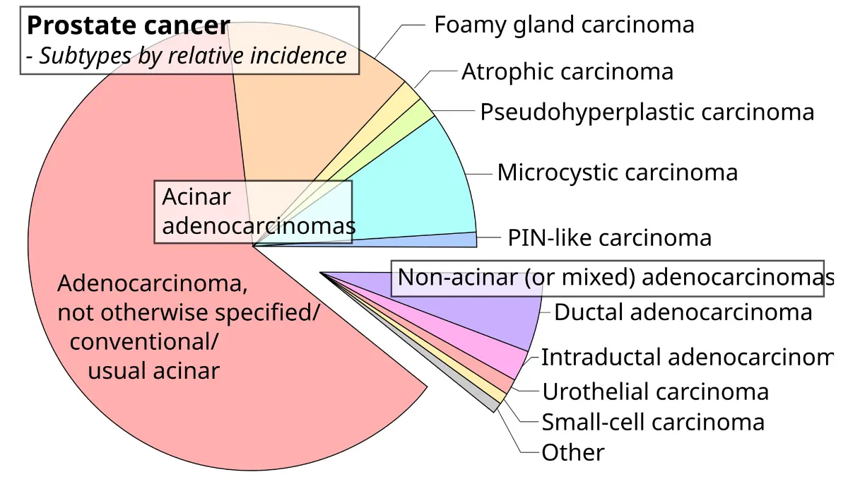 Vector diagram illustrating prostate gland cancer types relevant to prostate cancer screening.