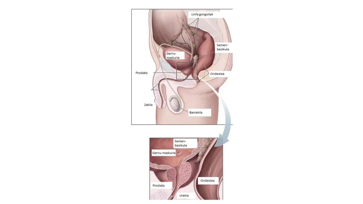 Prostate Cancer Under 50 sagittal medical illustration showing the prostate gland beneath the bladder and surrounding the urethra.