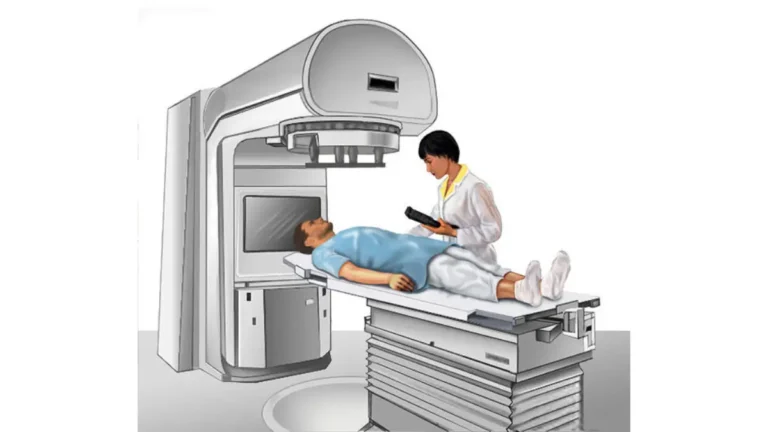 External beam Radiation therapy with a patient lying on a linear accelerator treatment table in a hospital setting.