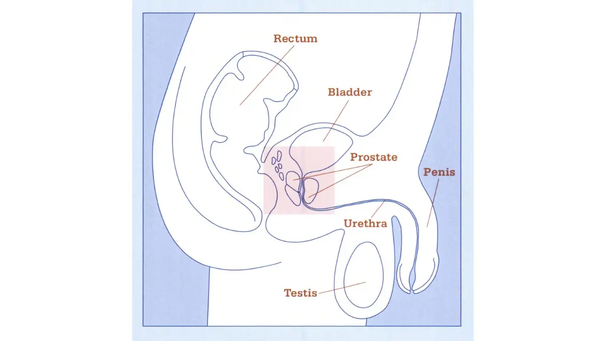 Medical illustration of the male pelvis showing the prostate, bladder, rectum, and urethra to explain Radiation therapy effects on nearby organs.