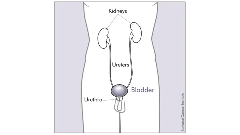 radical prostatectomy anatomy illustration showing the male bladder, prostate, urethra, kidneys, and nearby urinary organs.