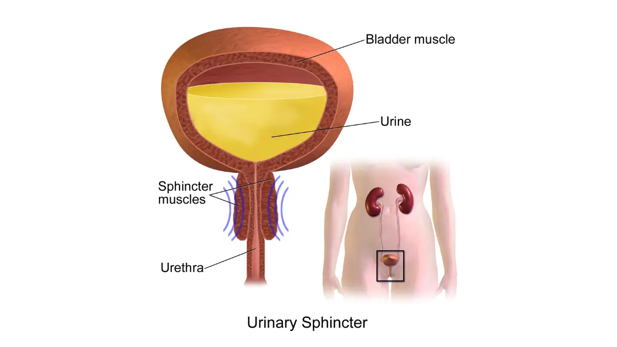 Anatomical diagram of the internal and external urethral sphincter valves explaining the mechanism of Urinary Incontinence.