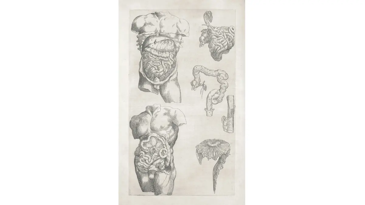 Vintage anatomical illustration of human intestines and torso for Virtual Colonoscopy comparison.