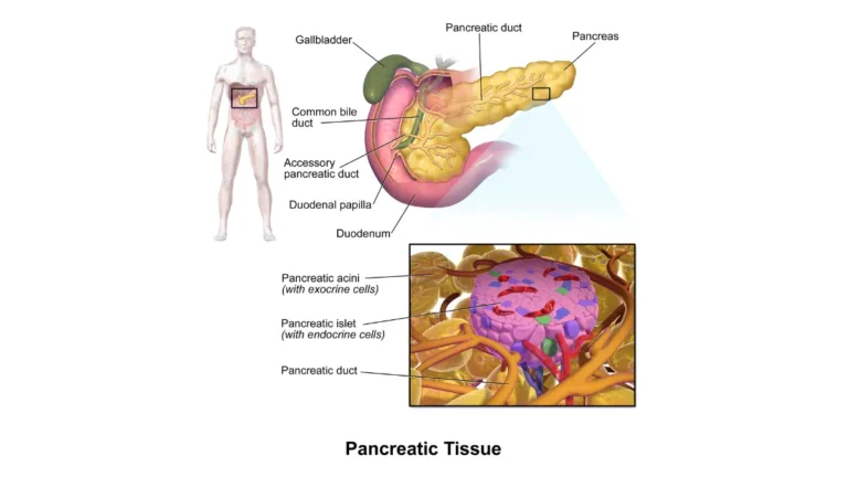 What Causes Pancreatic Cancer — Pancreatic tissue diagram showing exocrine and endocrine sections with islets of Langerhans and acinar cells.