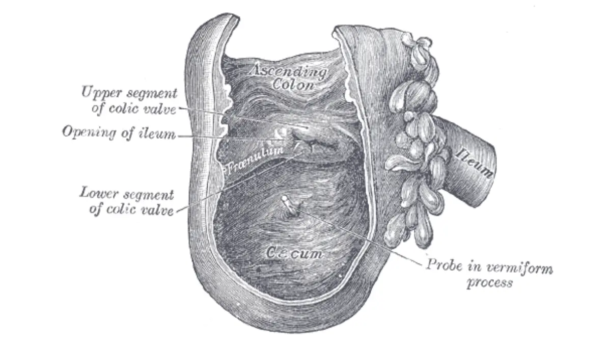 What Happens During a Colonoscopy: cecum and colic valve anatomy illustration showing the endpoint landmarks of the exam.