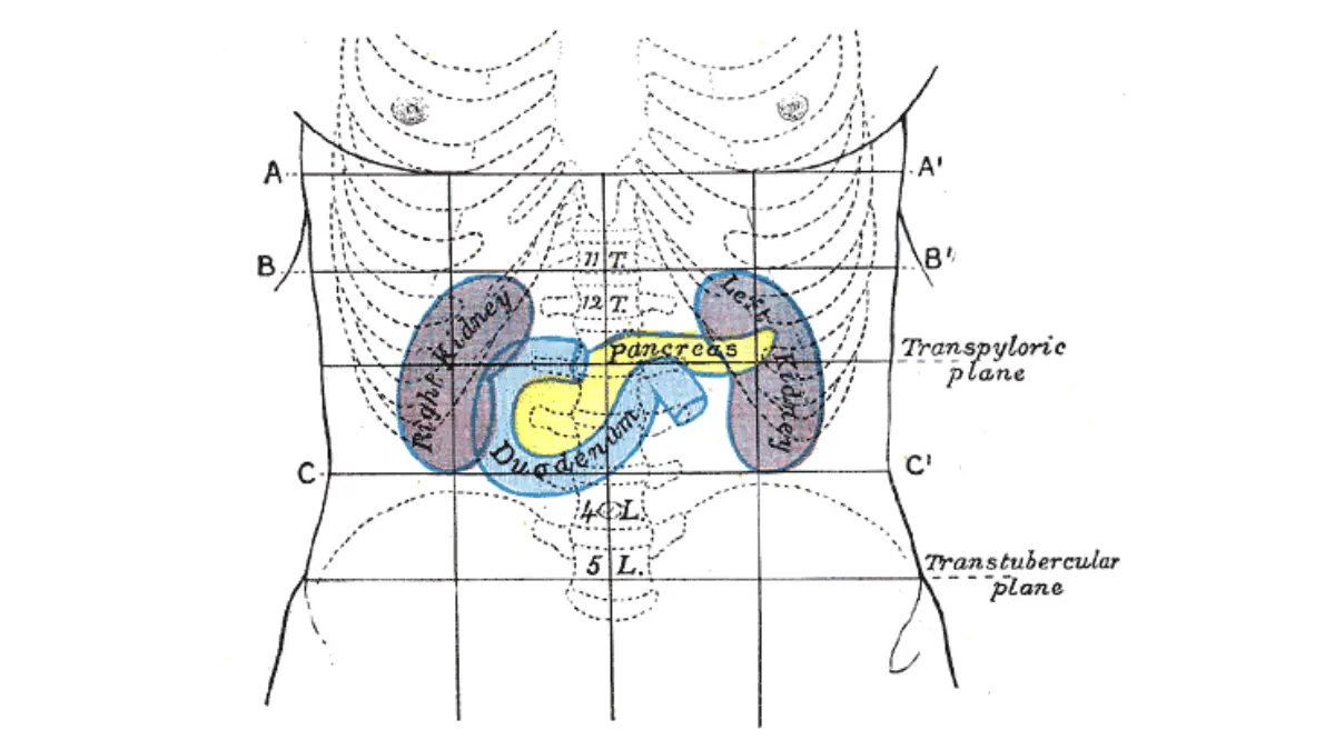 Whipple procedure surface anatomy illustration showing the upper abdomen and the area of the pancreas and duodenum.