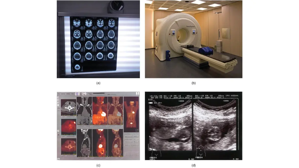 Side by side CT, MRI, and PET scan cross-sections illustrating how doctors check for solid organ masses beyond a normal CBC.