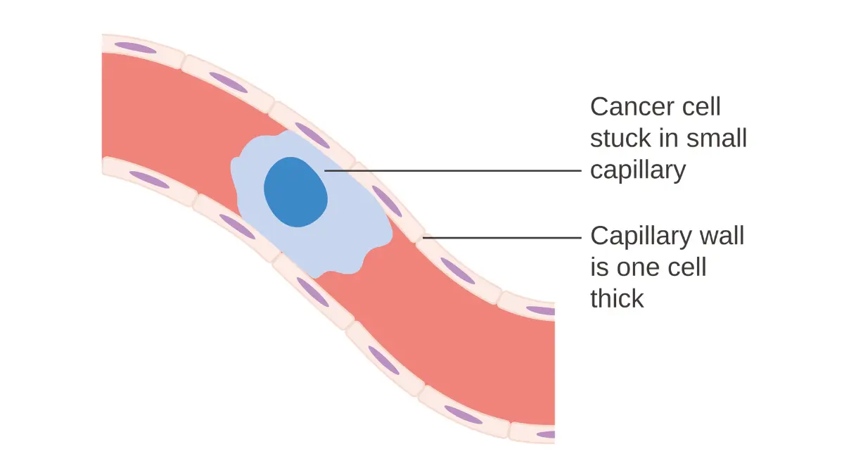 A medical vector diagram showing a tumor cell passing through blood vessels to clarify how a CMP detect cancer.