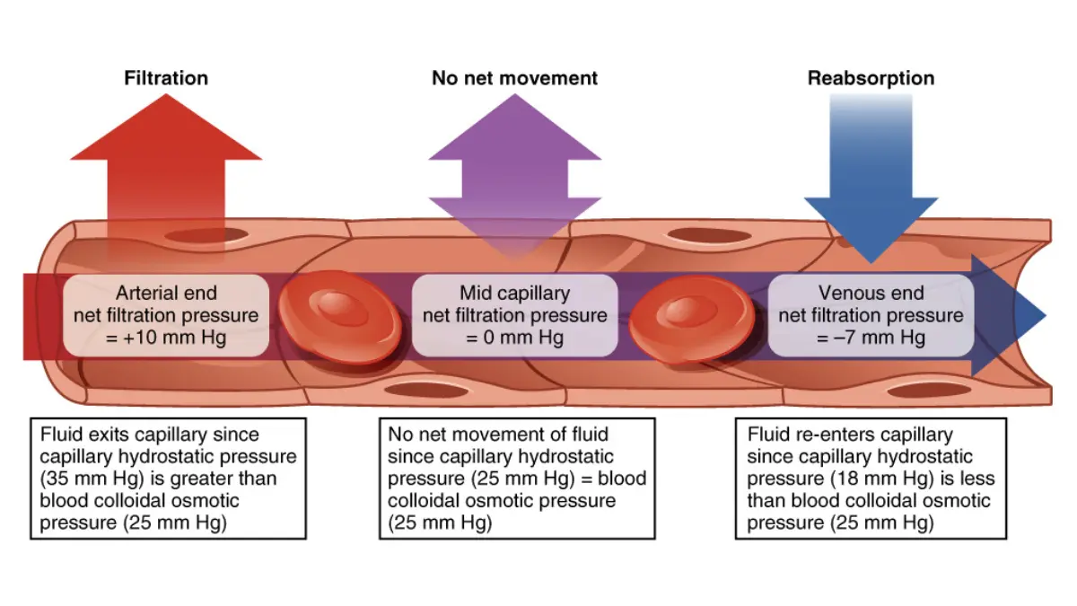 A flat medical anatomy vector illustration mapping capillary fluid exchange and oncotic pressure dynamics affected by low albumin.