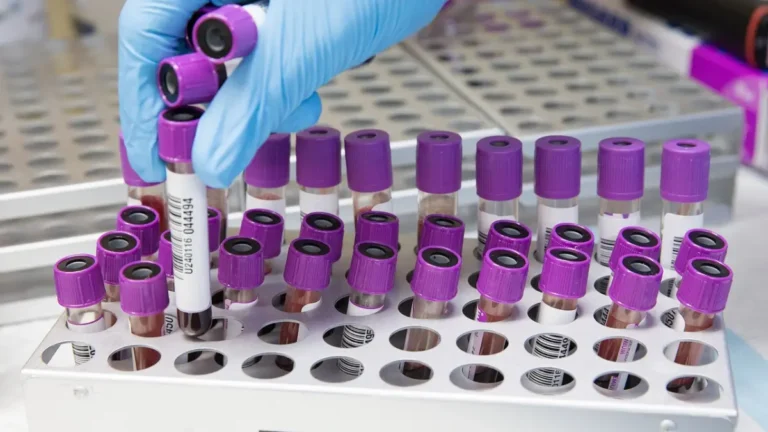 A medical vector illustration of a collection tube filled with a blood sample, representing a routine CBC blood test setup.