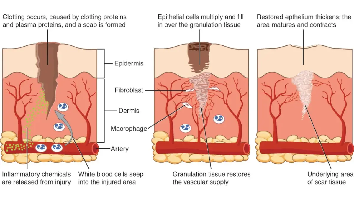 Microscopic vector schematic of cellular tissue architecture to show how a tissue biopsy provides a definitive diagnosis after a normal CBC.