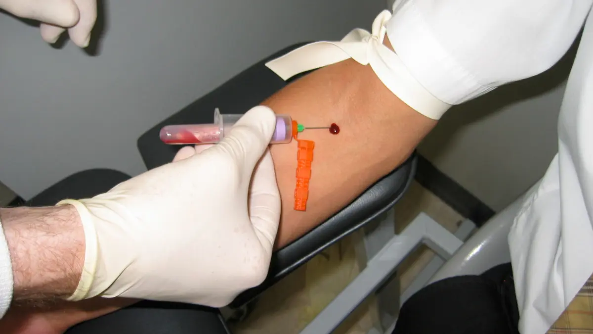 A vector diagram showing a clinical venipuncture procedure in the arm, illustrating proper needle entry for a patient preparing to fast for a blood draw.