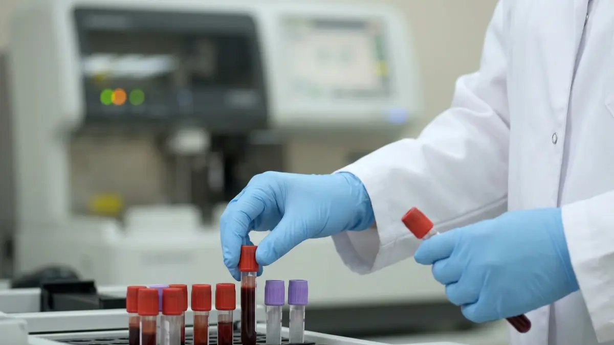 Rack of clinical laboratory blood collection tubes for CPT 80048 component testing.