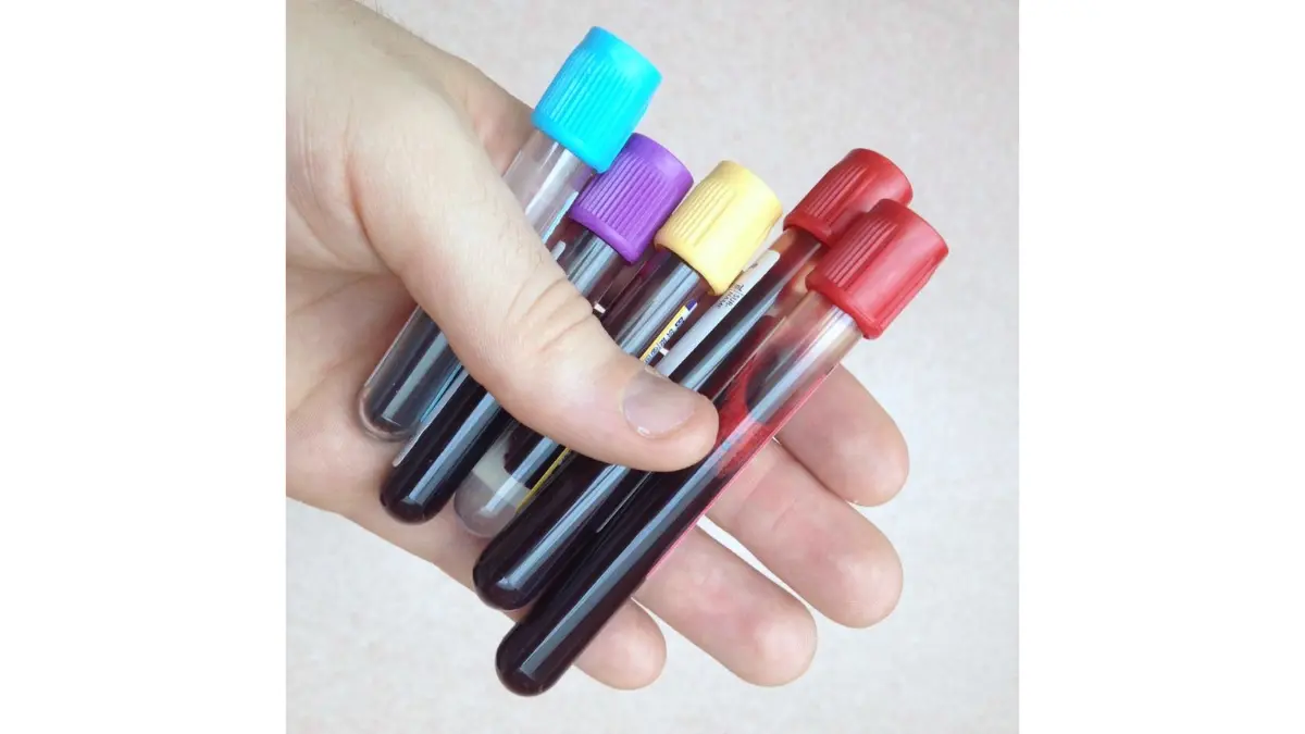 Color-coded clinical vacutainer tubes used during venipuncture to process a CBC covered by insurance.