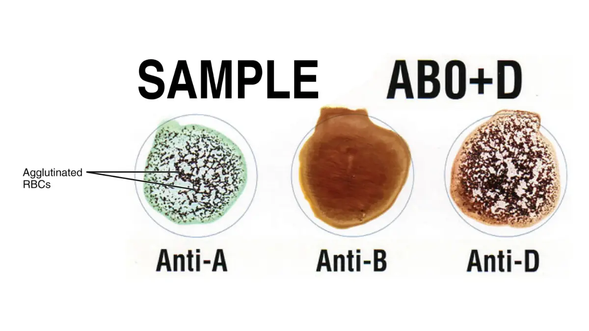 A detailed vector anatomy chart displaying cell surface properties to review while waiting for blood test results.