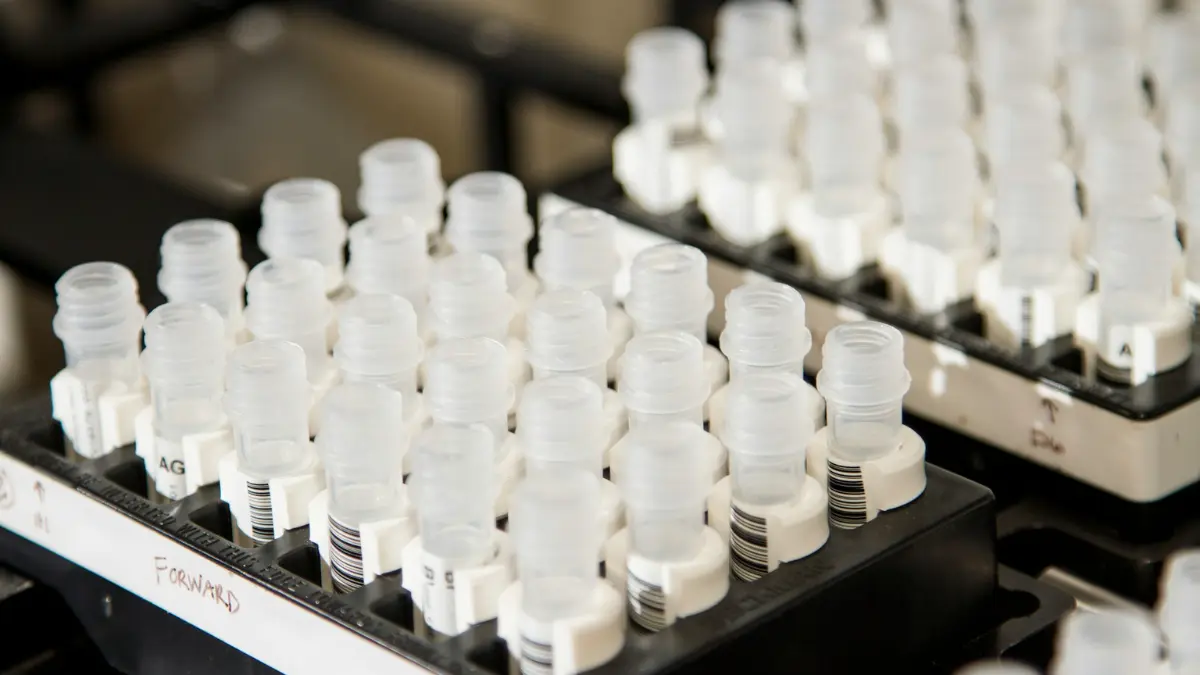 A rows of neatly arranged diagnostic fluid tubes used in advanced screening to check if a CMP detect cancer.