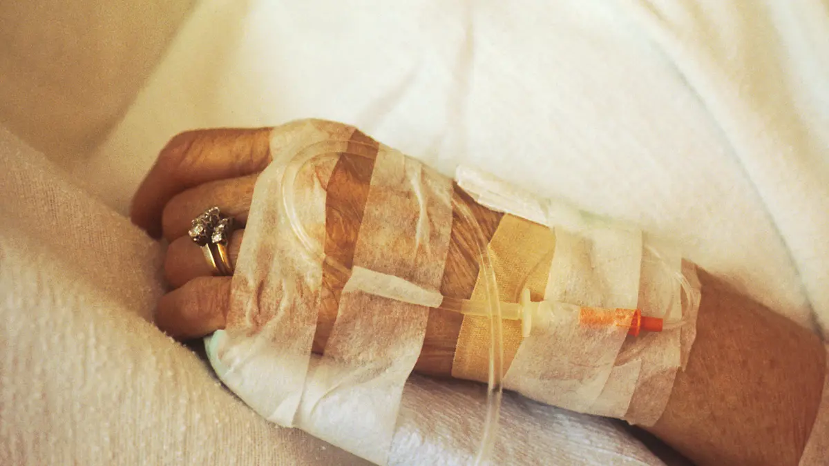 Close-up photo of an intravenous infusion needle line set up for a clinic patient, showcasing how physician-administered drug logistics impact pancreatic cancer treatment cost tracking under Medicare Part B.