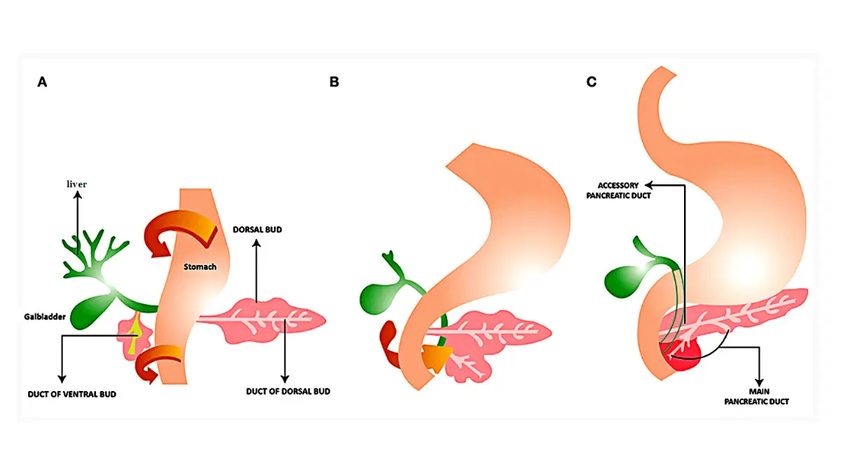Anatomy layout illustrating the orientation of the main pancreatic duct and duodenum for a Pancreatic Cancer Caregiver.