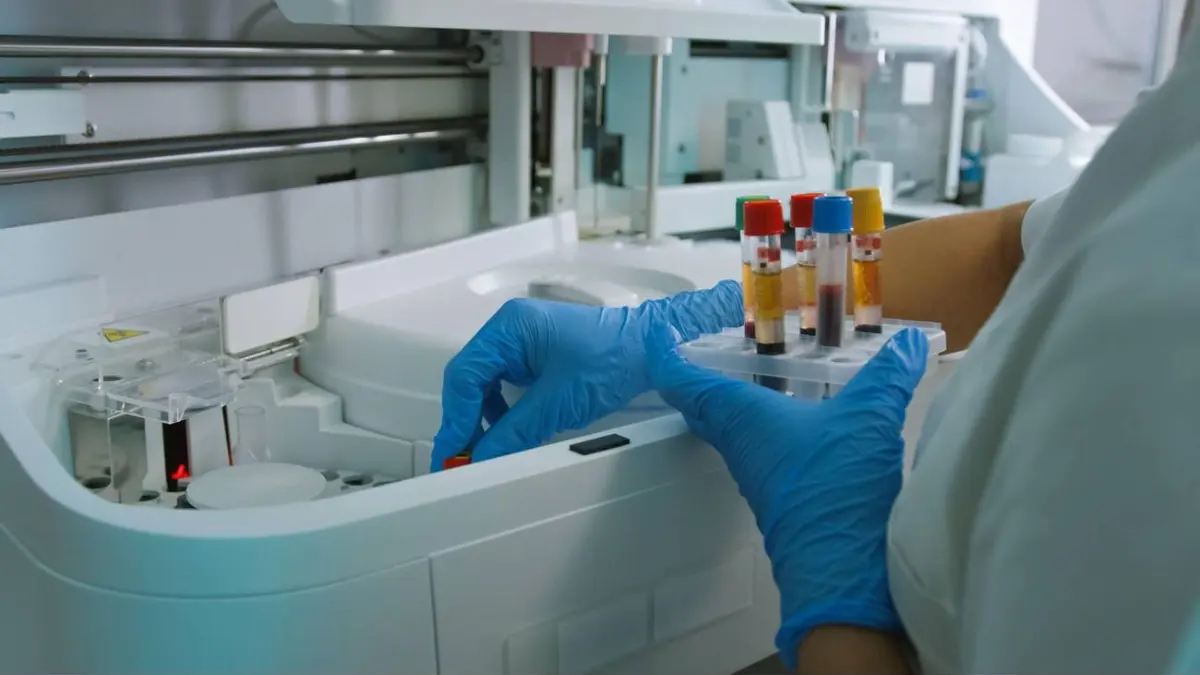 Clinical laboratory technician processing blood specimens during an Immigration or Work Physical.