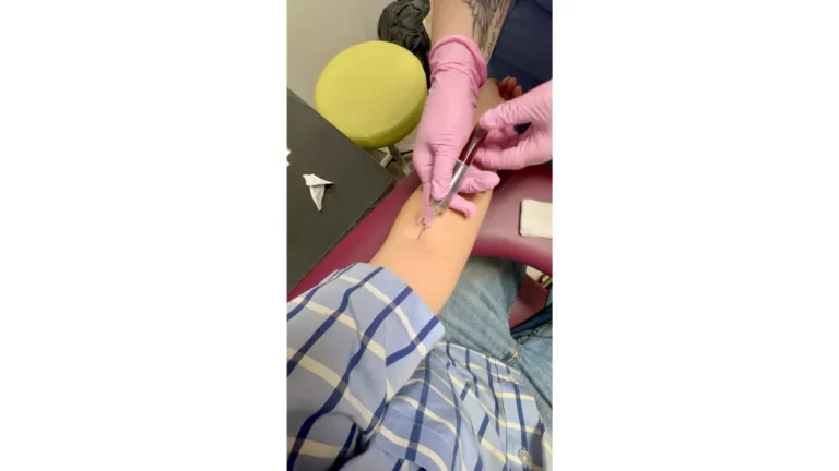 Fast for a BMP procedure showing a clinician drawing blood from a patient's arm vein.