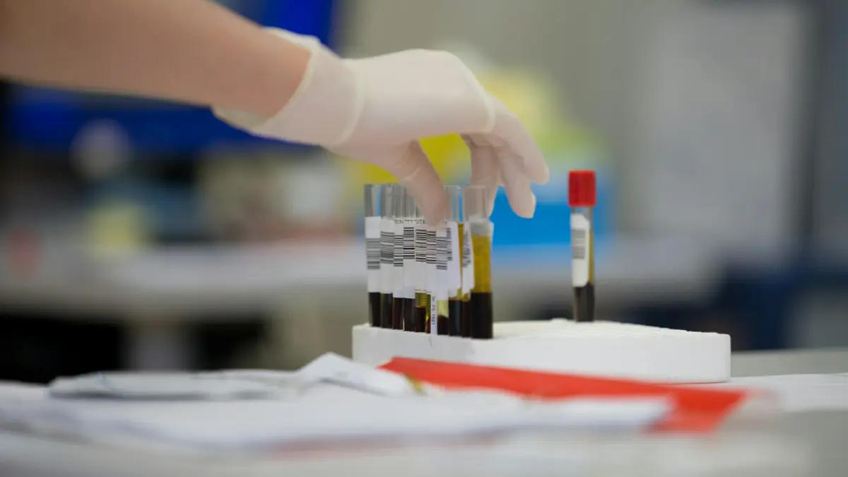 A gloved laboratory hand holding an inverted blood collection tube to evaluate mechanical high potassium causes like hemolysis.