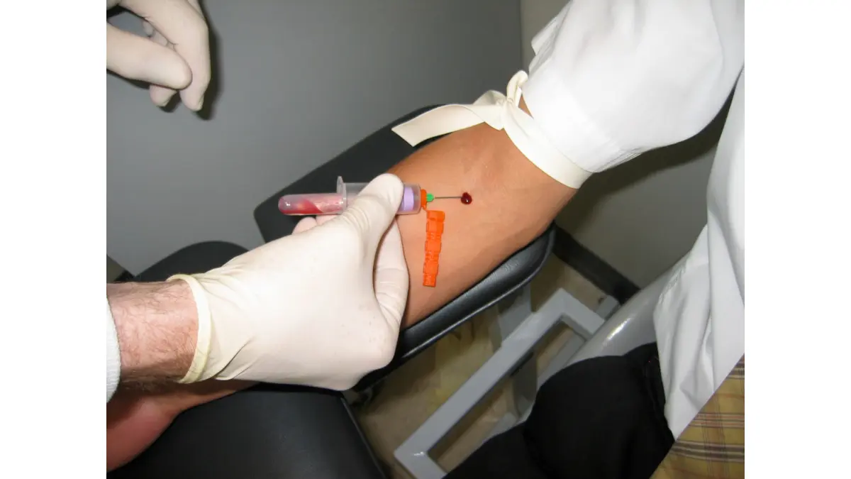 Close-up of a healthcare provider successfully drawing a patient blood sample into a purple-top tube for an accurate CBC Test.