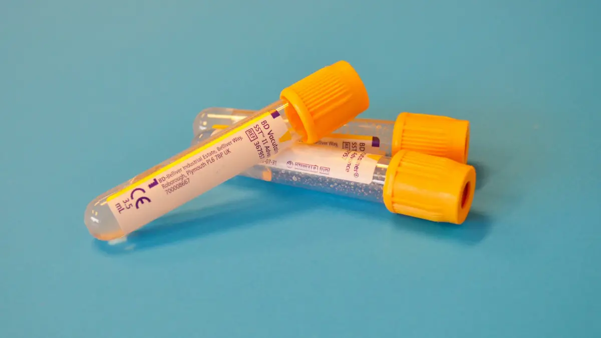 Clinical serum separator vacutainer blood collection tubes during venipuncture processing for a comprehensive metabolic panel to calculate Total Protein.
