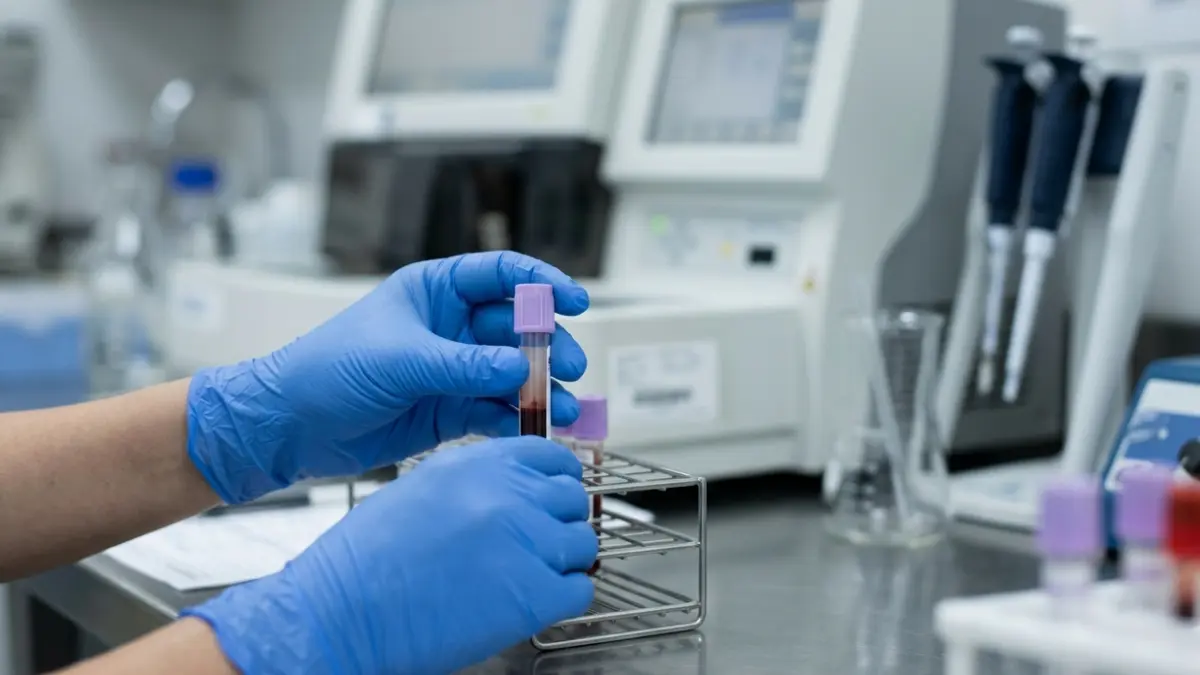 Glucose Levels: blood sample being processed in a clinical laboratory